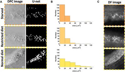 Asymmetrical Illumination Enables Lipid Droplets Segmentation in Caenorhabditis elegans Using Epi-Illumination Dark Field Microscopy